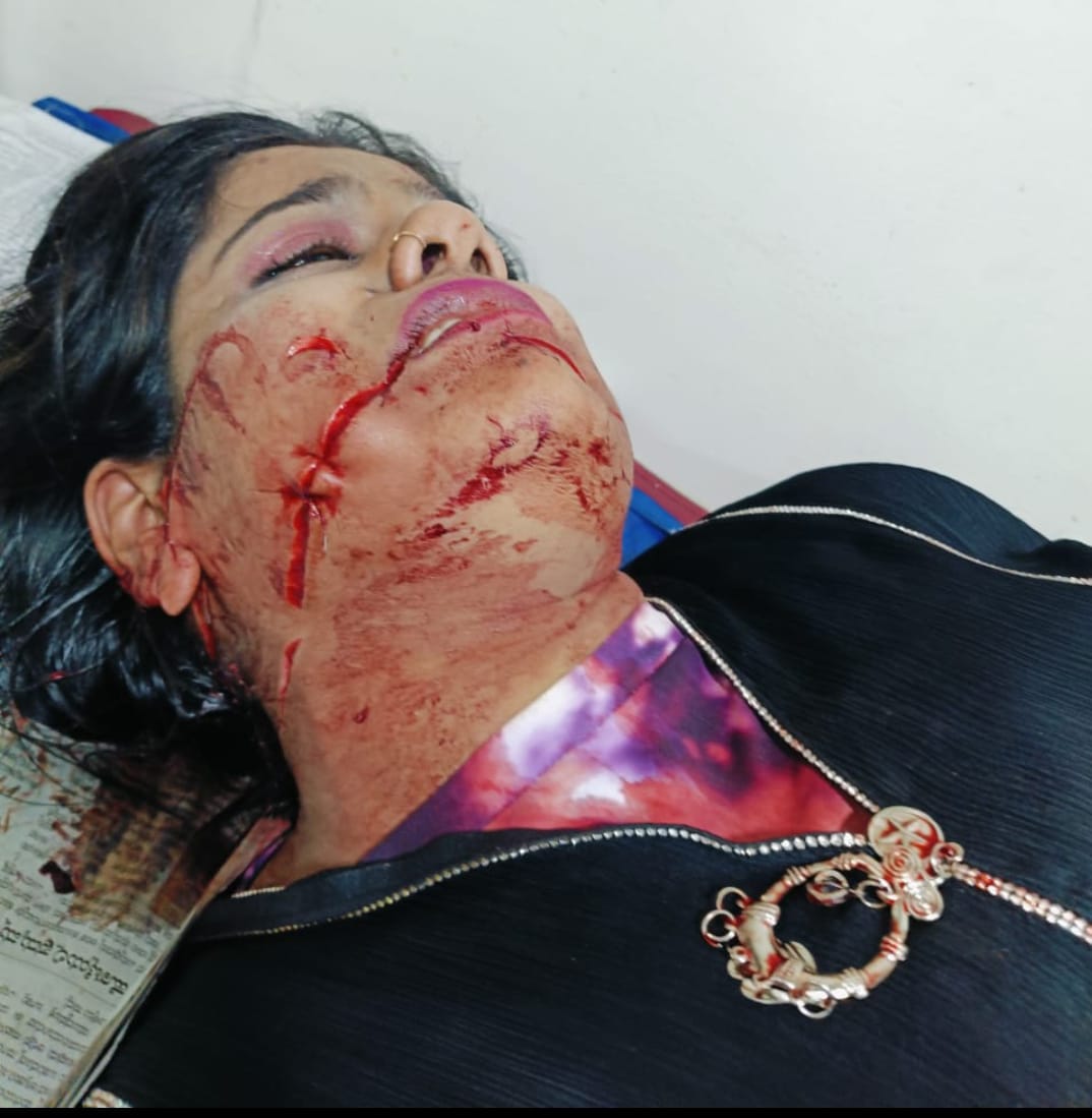 ఫ్రీ ఫైర్ గేమ్ ఆడుతున్న బాలుడు తల్లి పై కొడుకు కత్తితో దాడి ఫ్రీ ఫైర్ గేమ్ ఆడుతున్న బాలుడు తల్లి పై కొడుకు కత్తితో దాడి